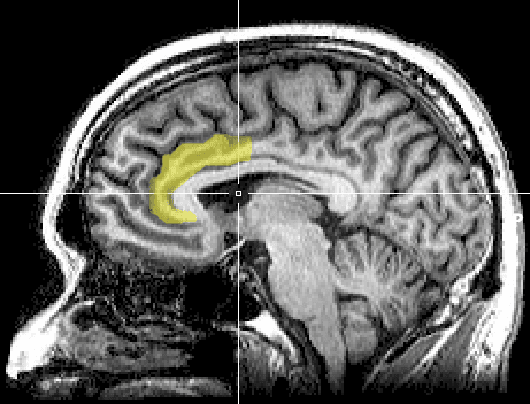 Brain activity changes during Yoga Nidra